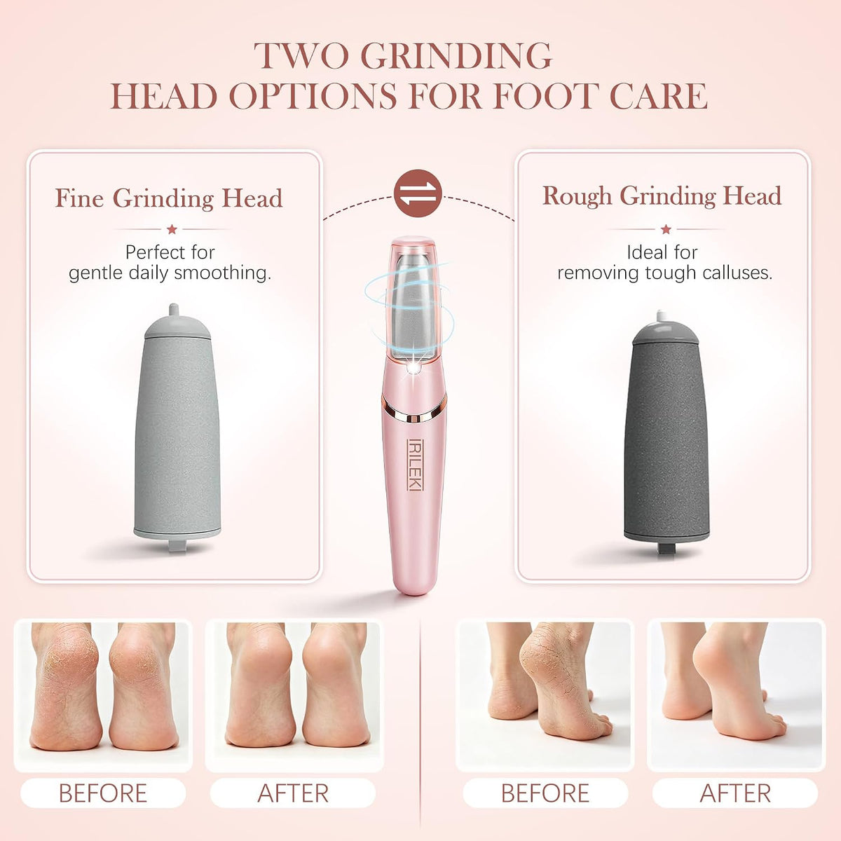 Electric Foot File
